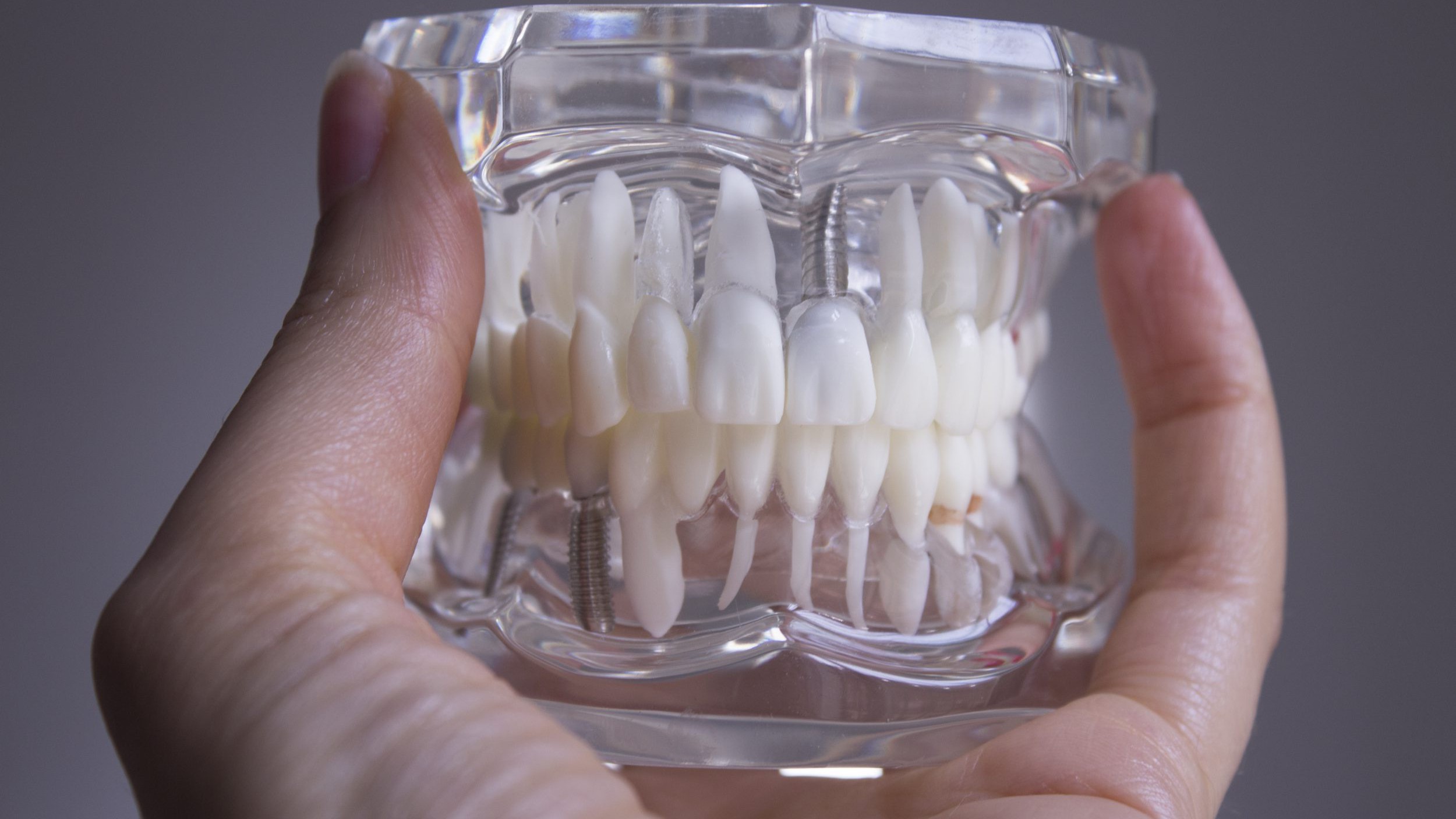 False teeth gripped by the hand of a woman.