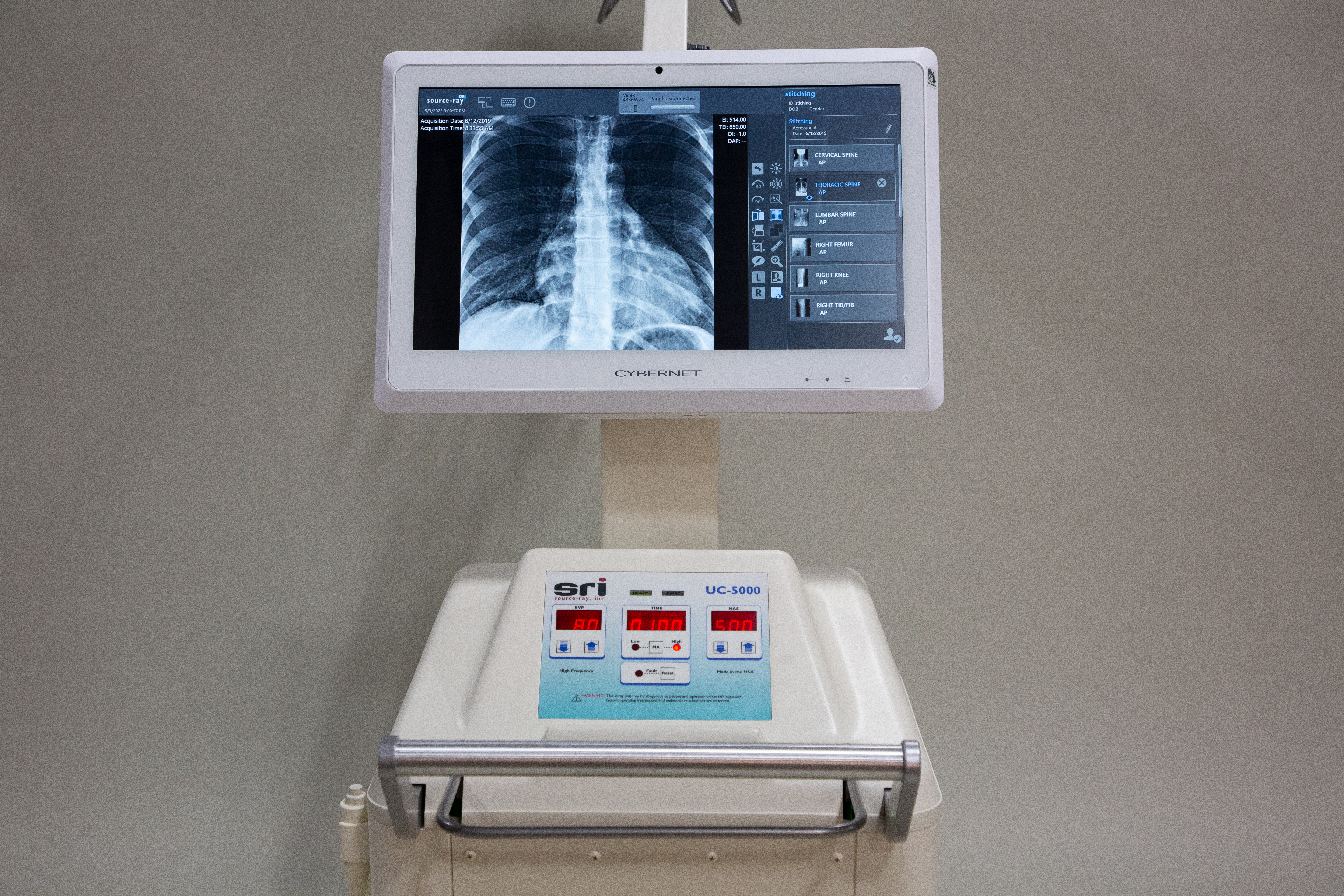 SOURCE-RAY, INC. Product Image 1