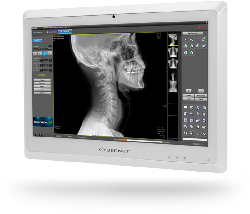 4k Radiology Monitor Designed for Diagnostic Imaging